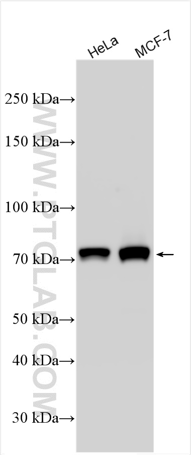 WB analysis using 14078-1-AP