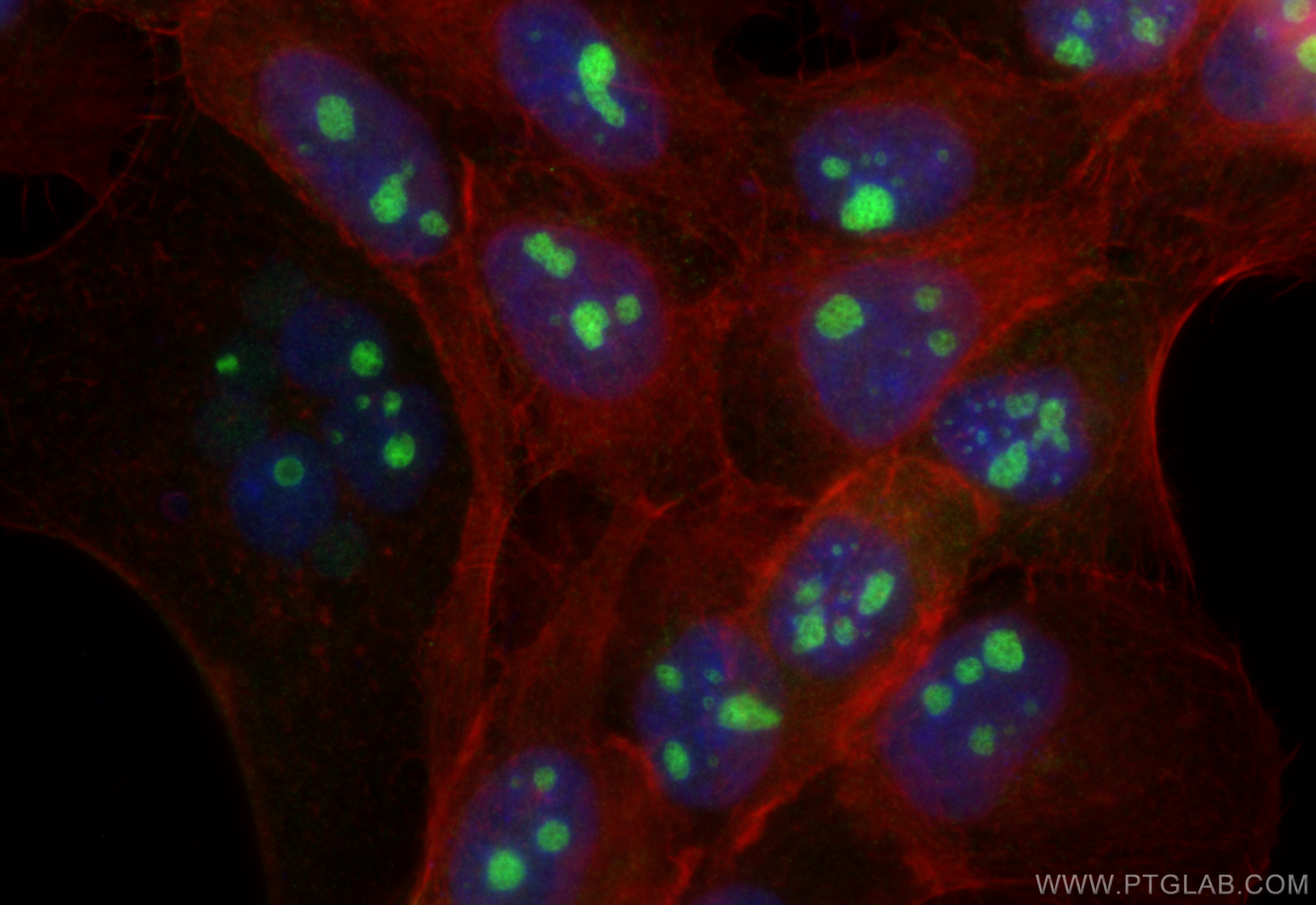 IF Staining of A431 using 10190-2-AP
