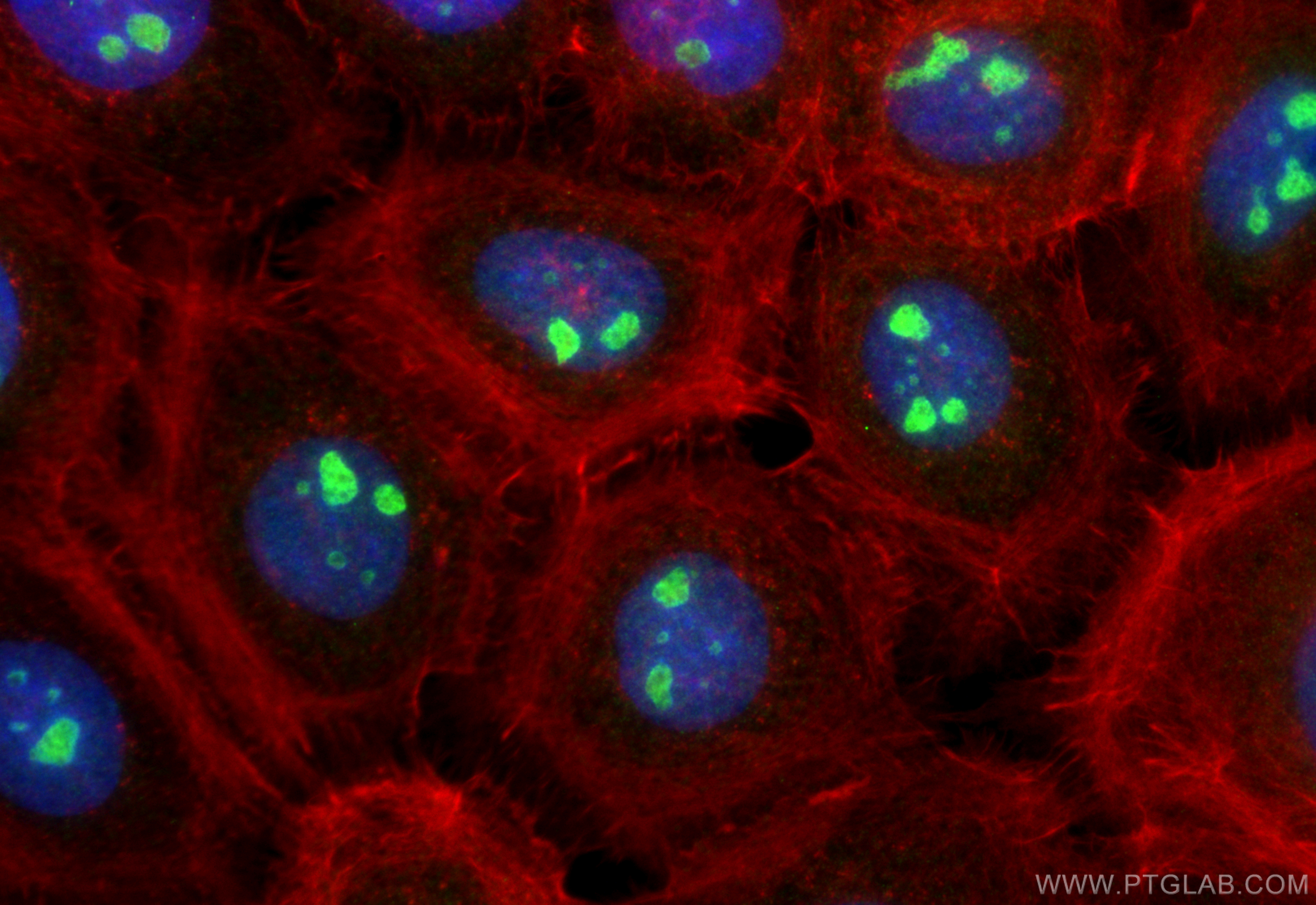 IF Staining of A431 using 10190-2-AP