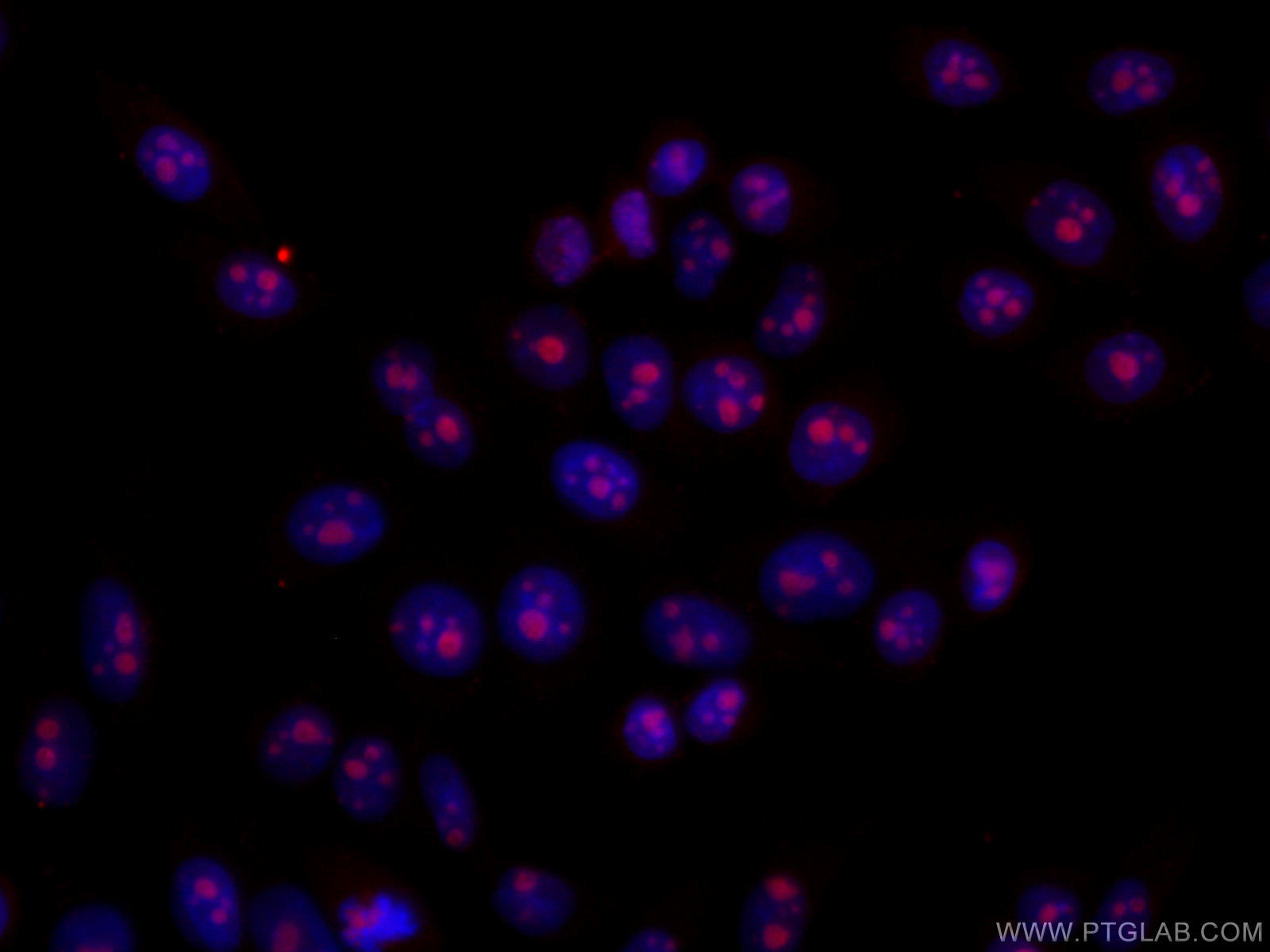 IF Staining of HeLa using 67169-1-Ig