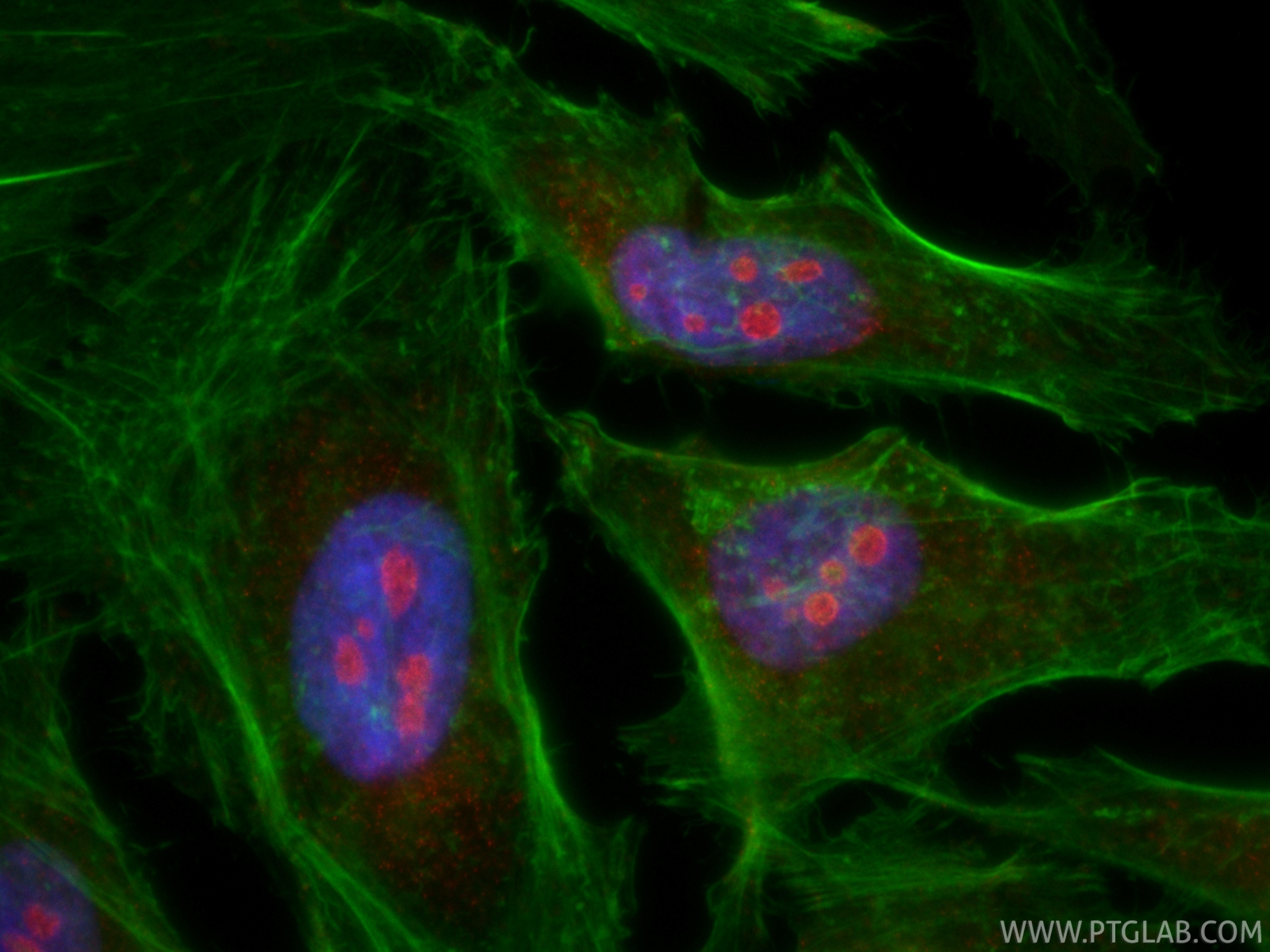 IF Staining of HeLa using CL594-67169