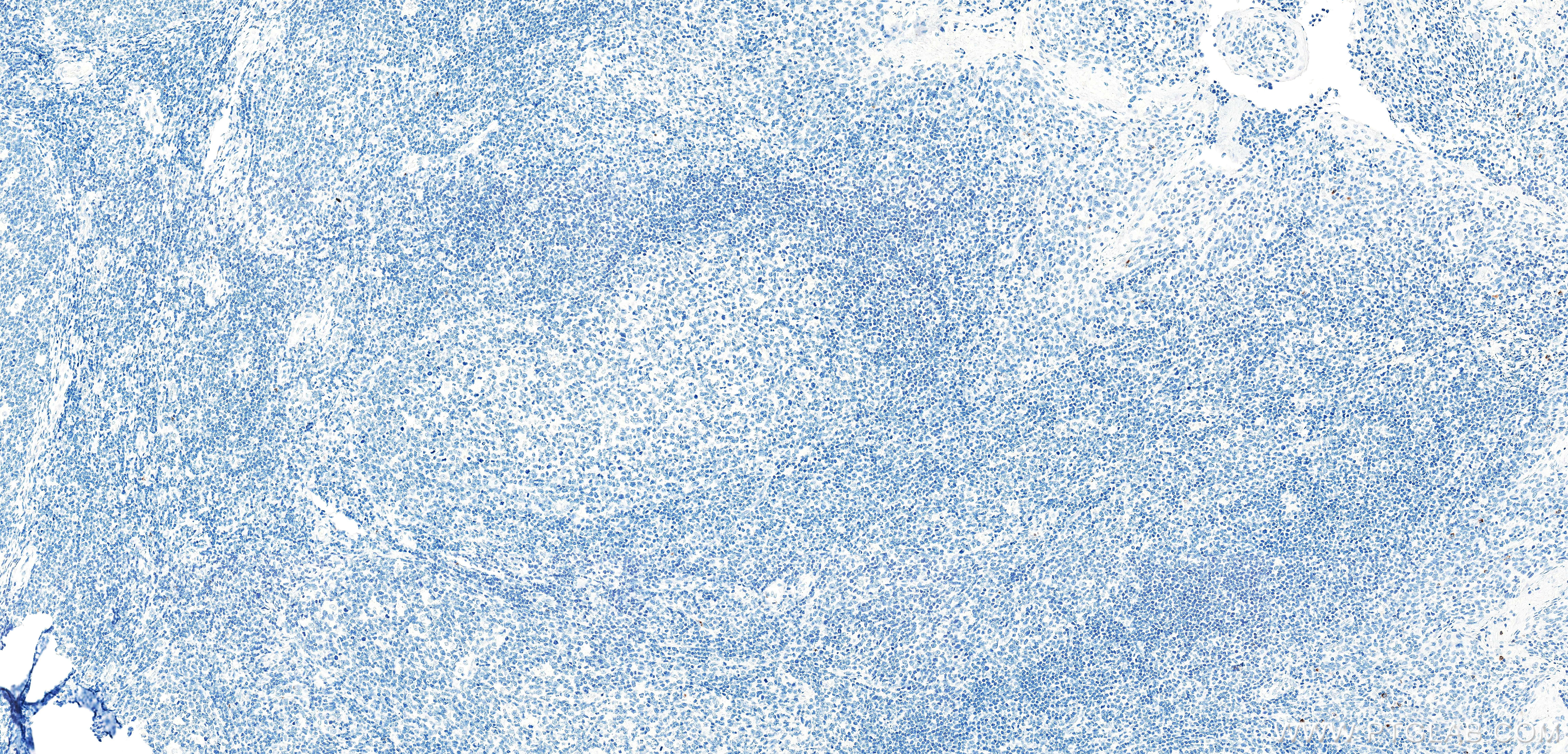 IHC staining of human tonsil using 87707-3-RR (same clone as 87707-3-PBS) IHC staining of human tonsil using 87707-3-RR (same clone as 87707-3-PBS)