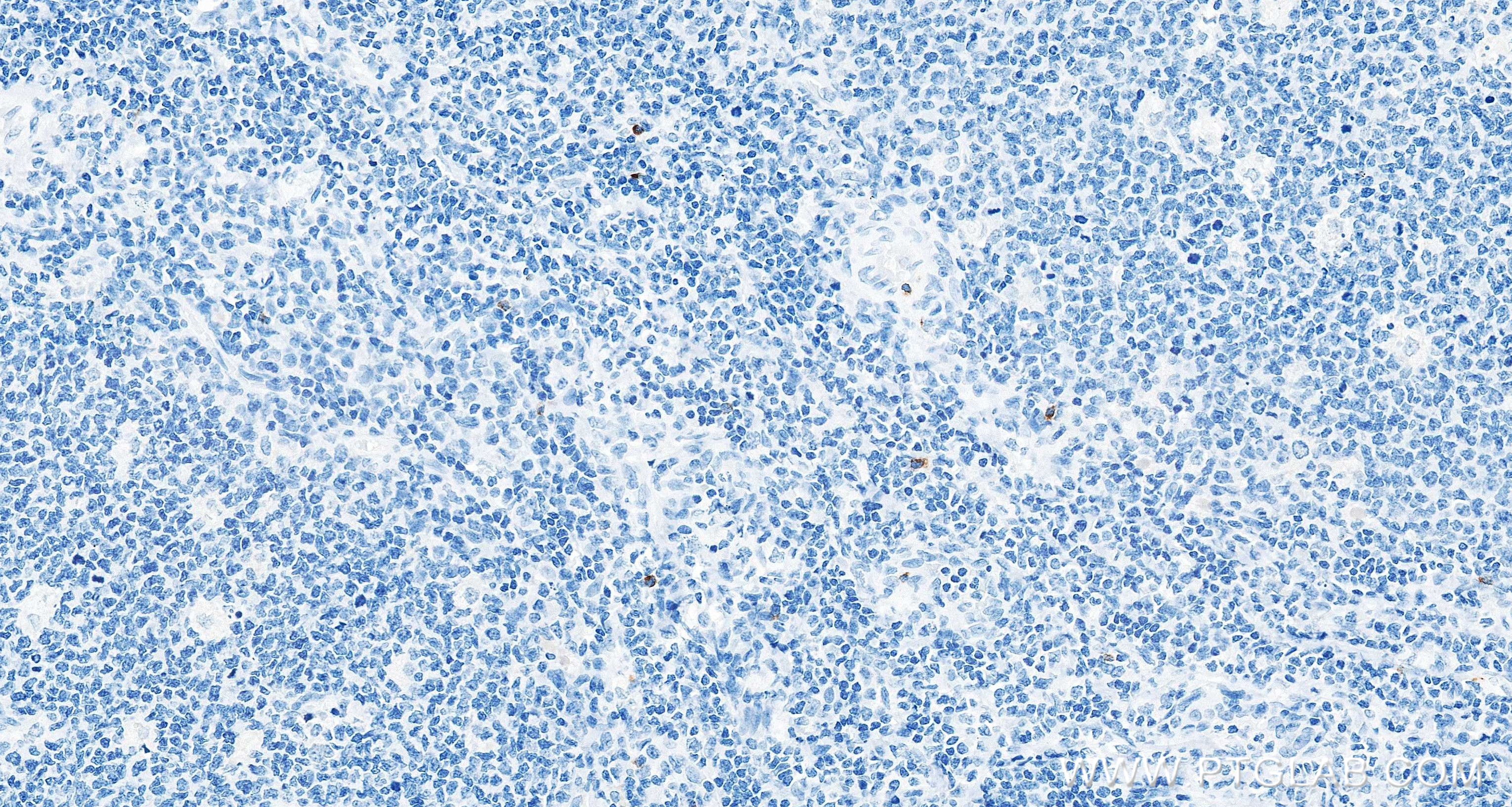 IHC staining of human tonsil using 87707-3-RR (same clone as 87707-3-PBS) IHC staining of human tonsil using 87707-3-RR (same clone as 87707-3-PBS)