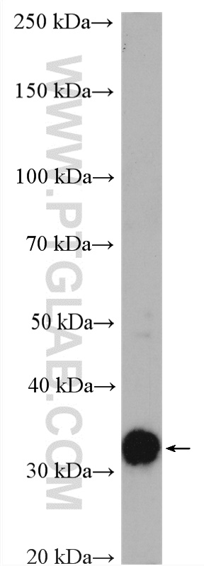 WB analysis of rat liver using 18790-1-AP