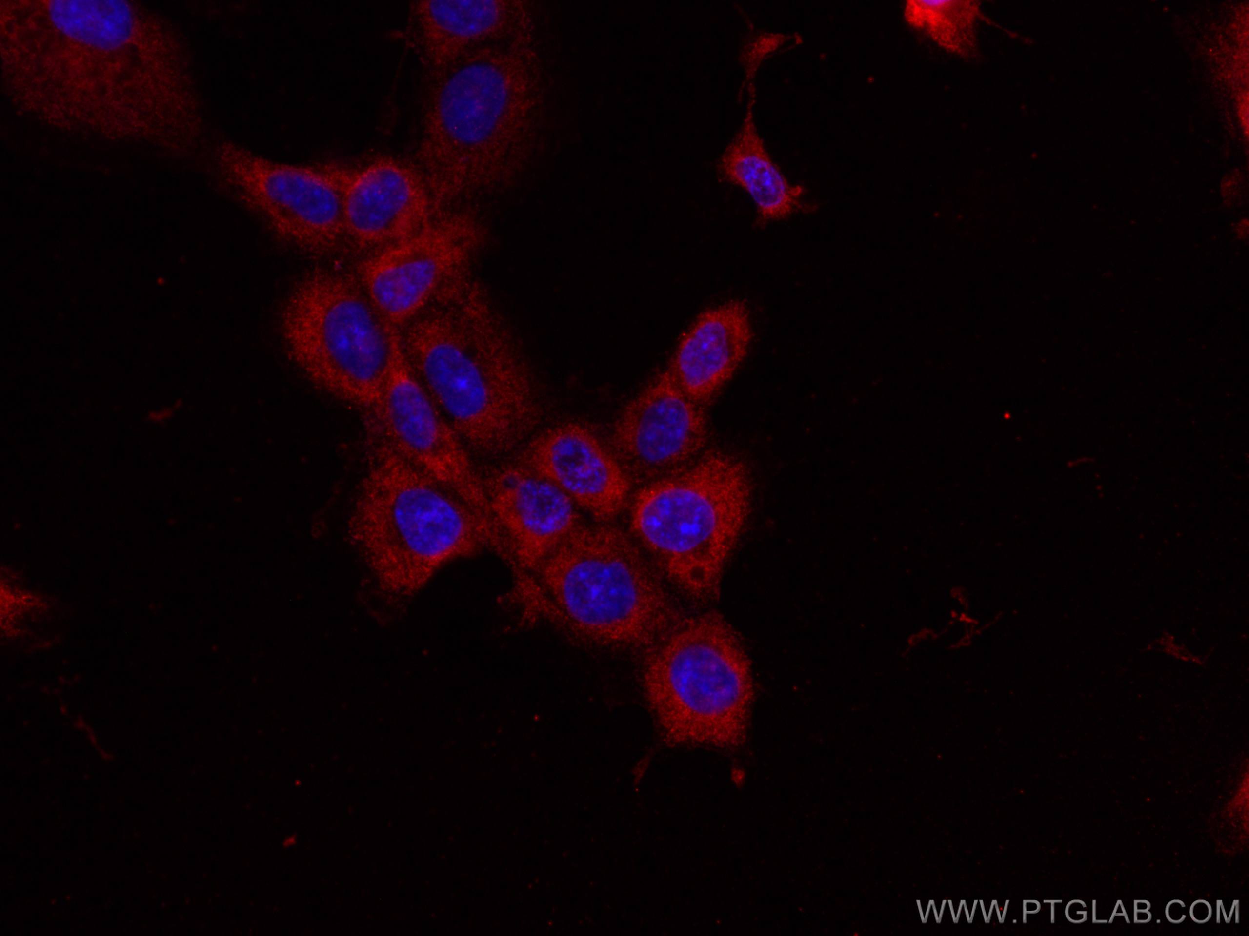 IF Staining of A431 using 67294-1-Ig