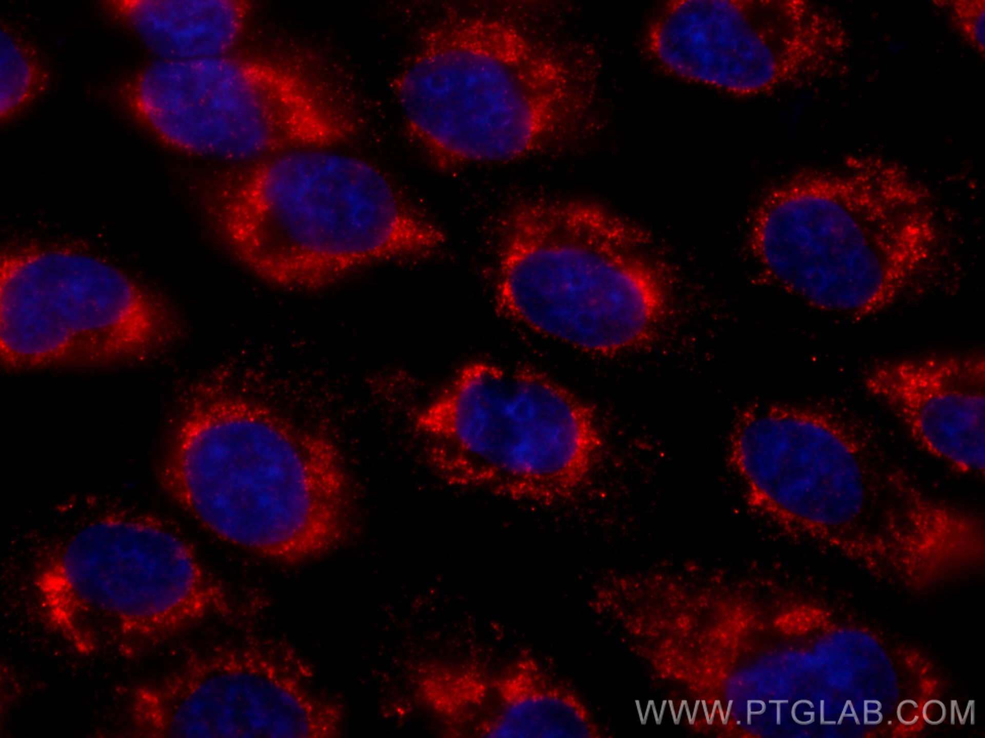 IF Staining of A431 using CL594-67294