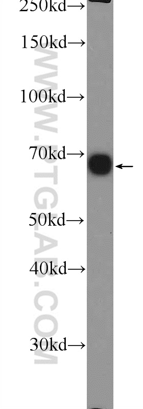 WB analysis of HepG2 using 14931-1-AP