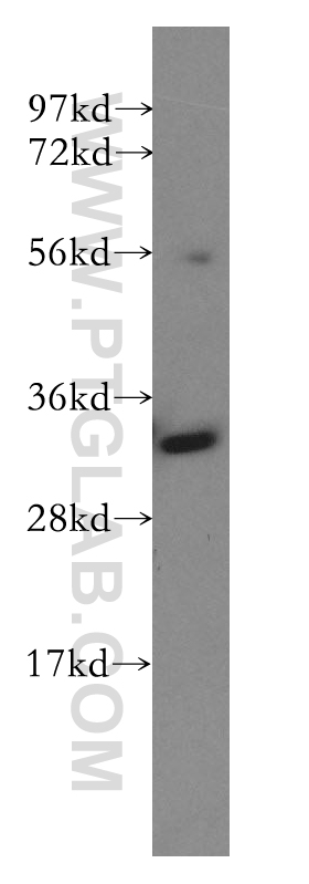 WB analysis of K-562 using 12312-1-AP