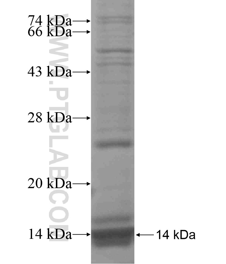 GNPTAB fusion protein Ag16950 SDS-PAGE GNPTAB fusion protein Ag16950 SDS-PAGE