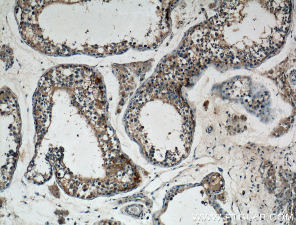 IHC staining of human testis using 22462-1-AP