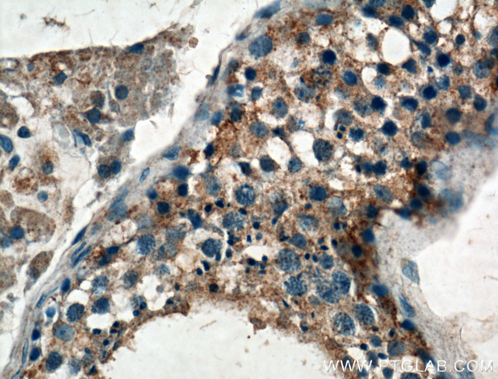 IHC staining of human testis using 22462-1-AP