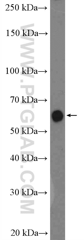 WB analysis of mouse ovary using 22462-1-AP