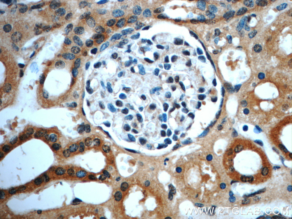 IHC staining of human kidney using 20728-1-AP