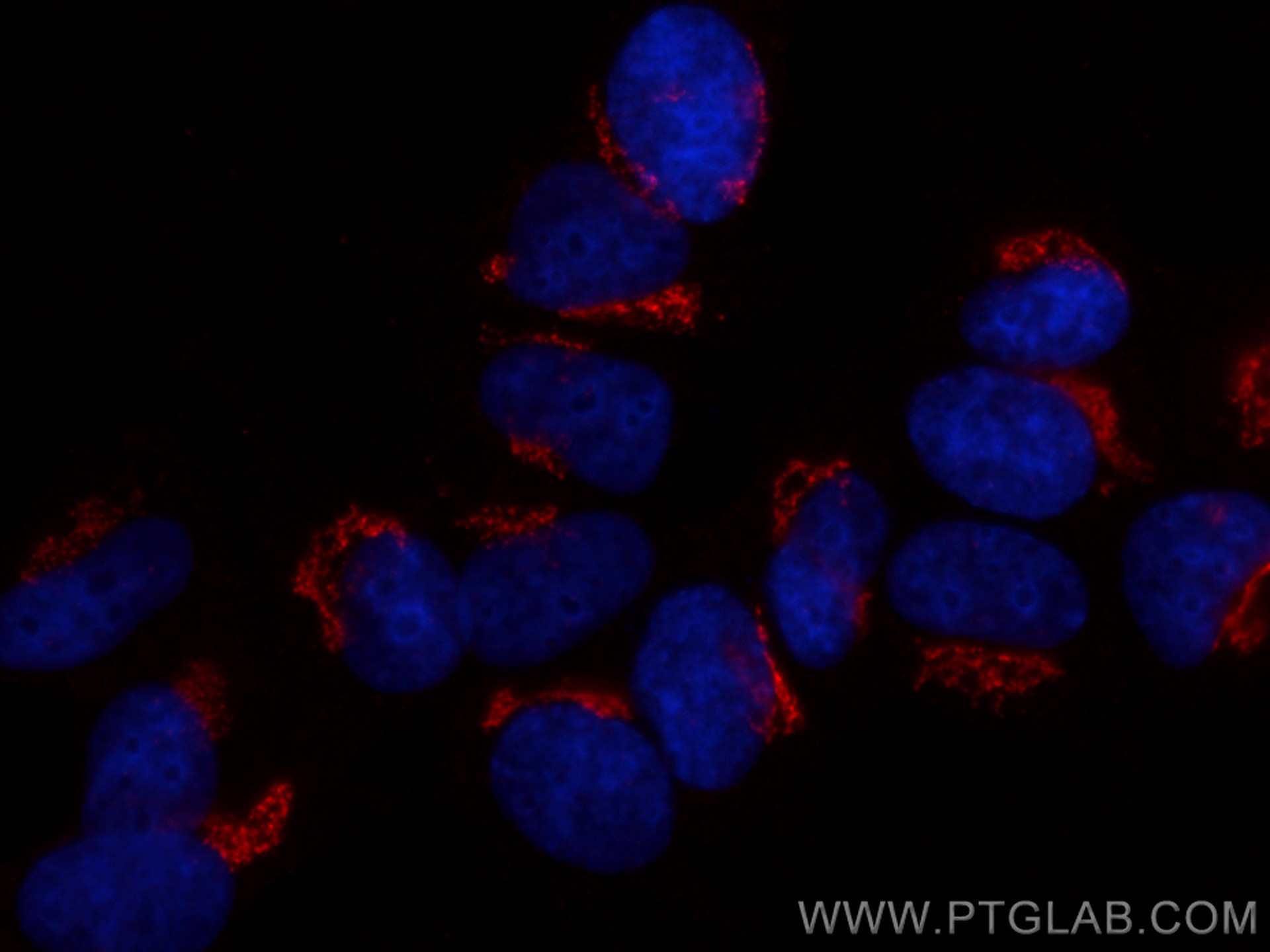 IF Staining of MCF-7 using 68648-1-Ig (same clone as 68648-1-PBS)