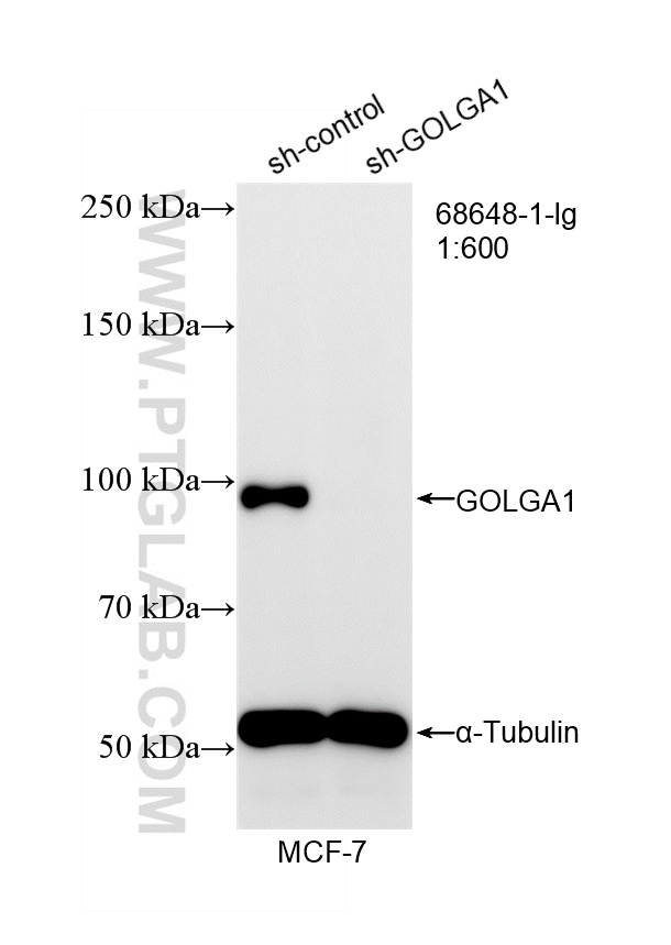 WB analysis of MCF-7 using 68648-1-Ig WB analysis of MCF-7 using 68648-1-Ig