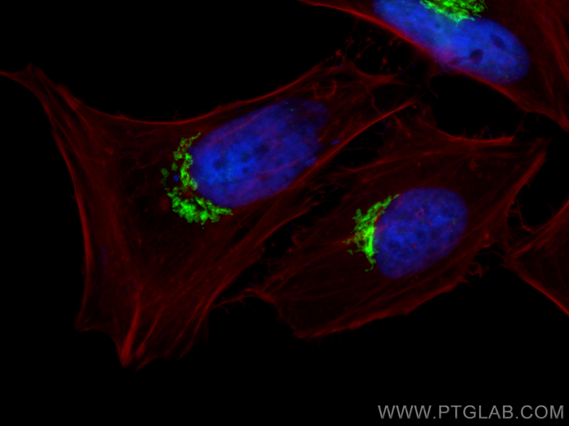 IF Staining of HeLa using 11308-1-AP