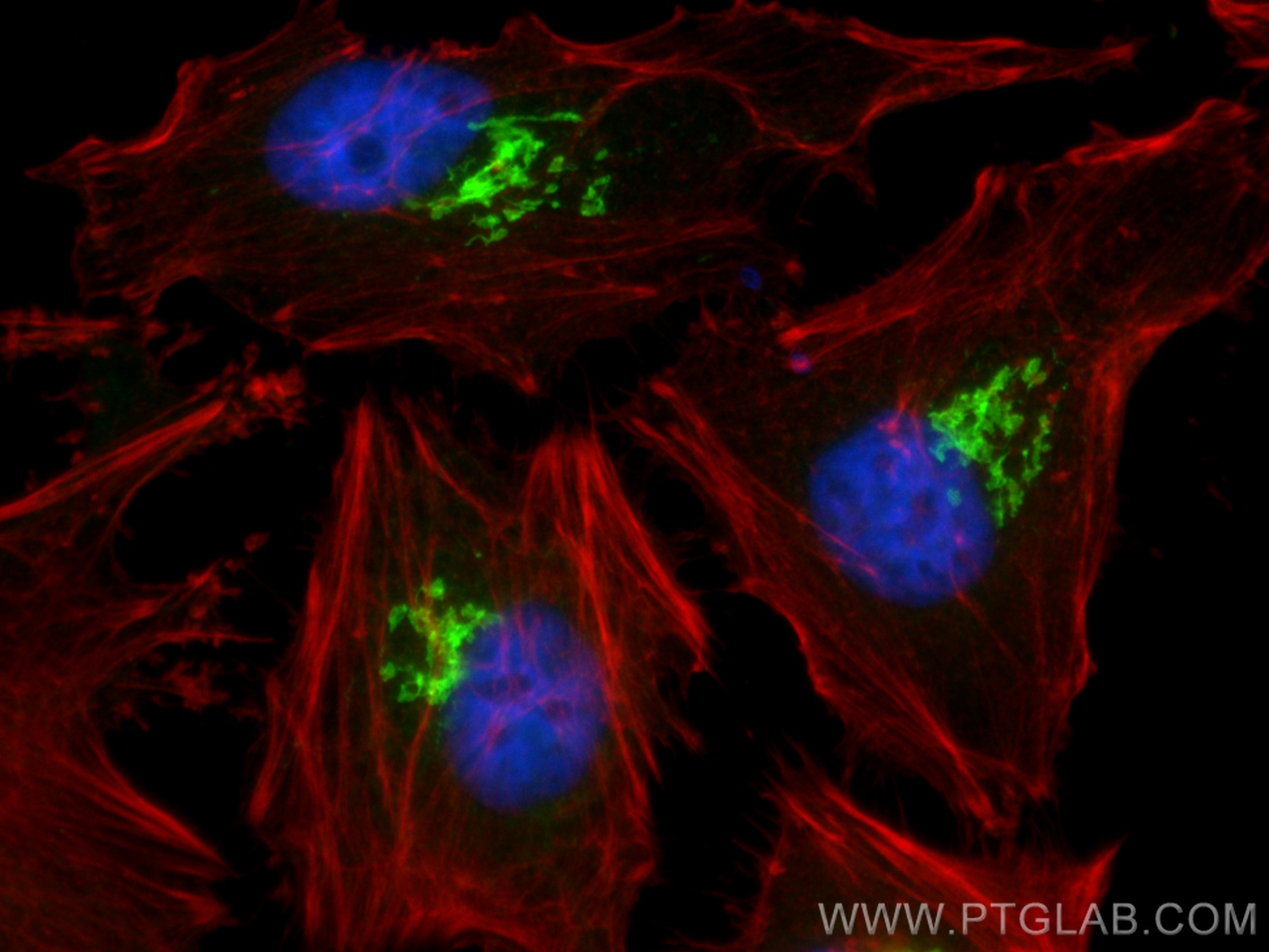 IF Staining of HeLa using 11308-1-AP