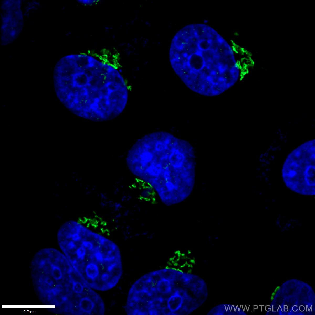 GOLGA2/GM130 Polyclonal antibody