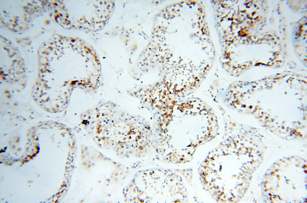 IHC staining of human testis using 11308-1-AP