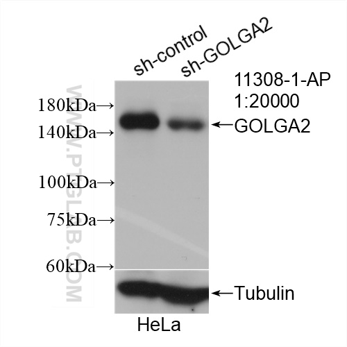 WB analysis of HeLa using 11308-1-AP