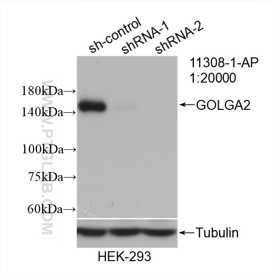 WB analysis of HEK-293 using 11308-1-AP