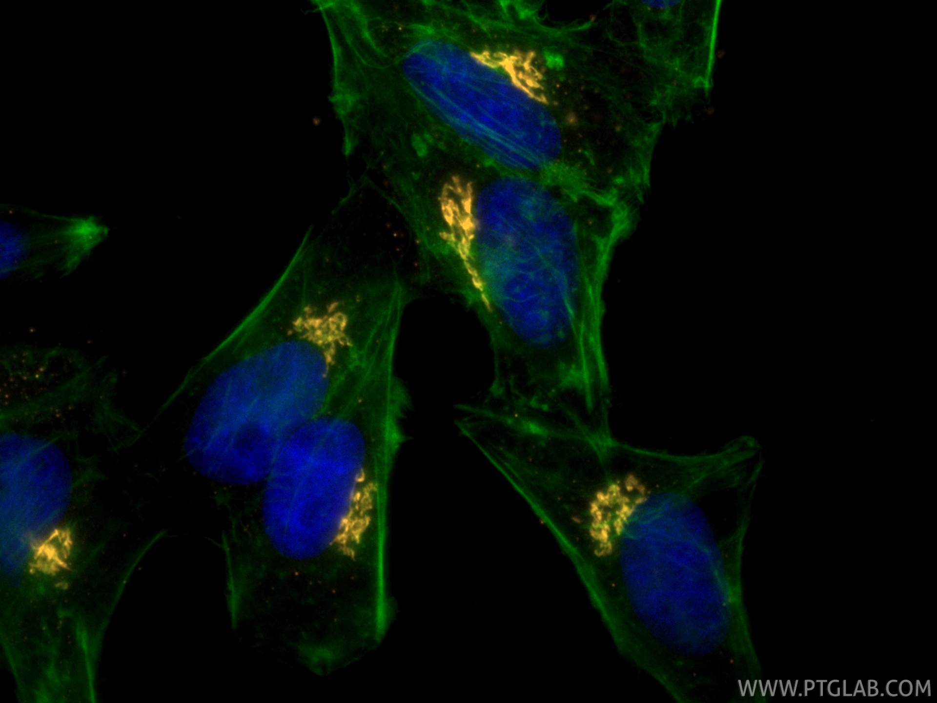 IF Staining of HepG2 using CL555-11308 IF Staining of HepG2 using CL555-11308