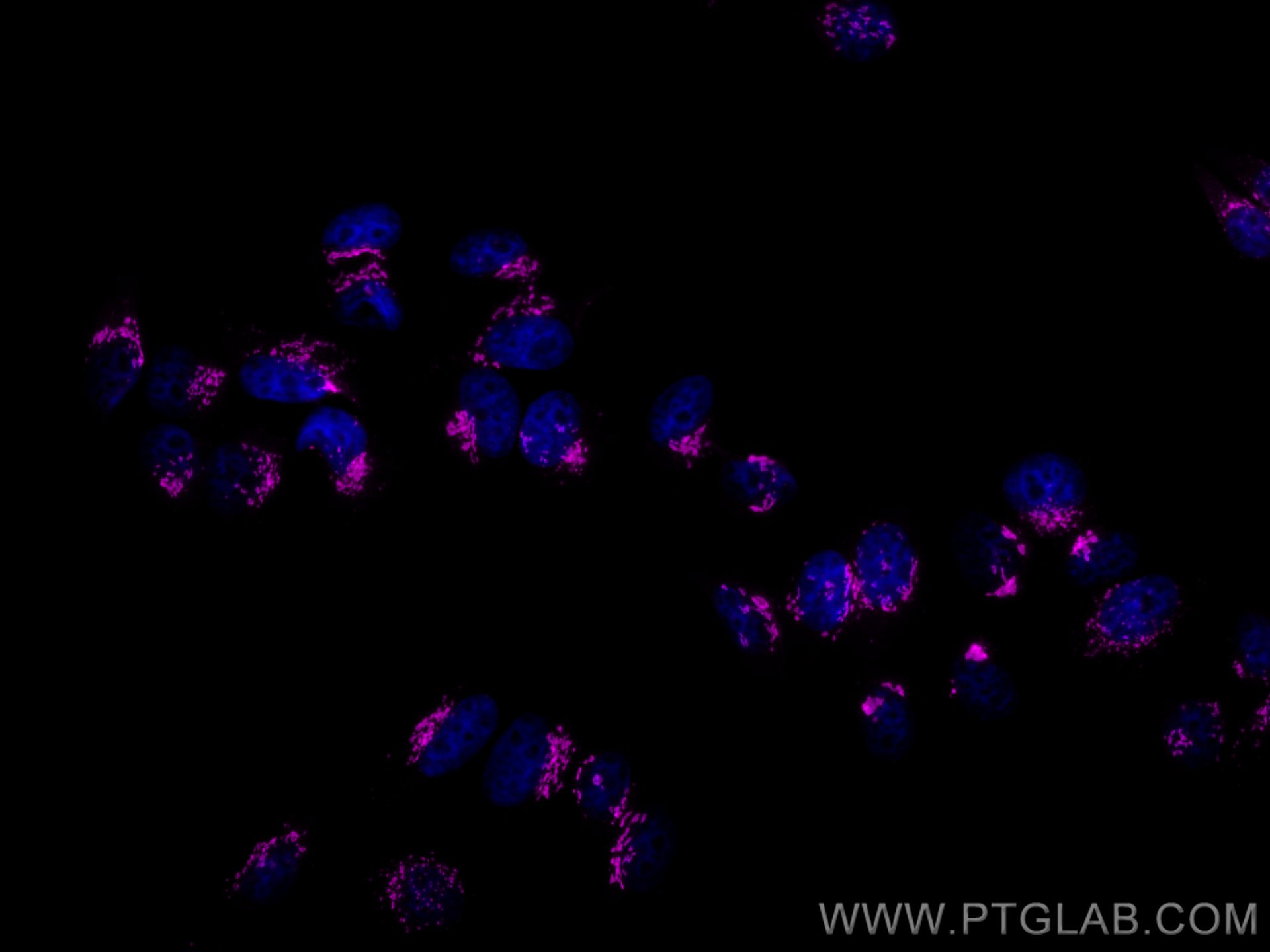 IF Staining of HepG2 using CL647-11308