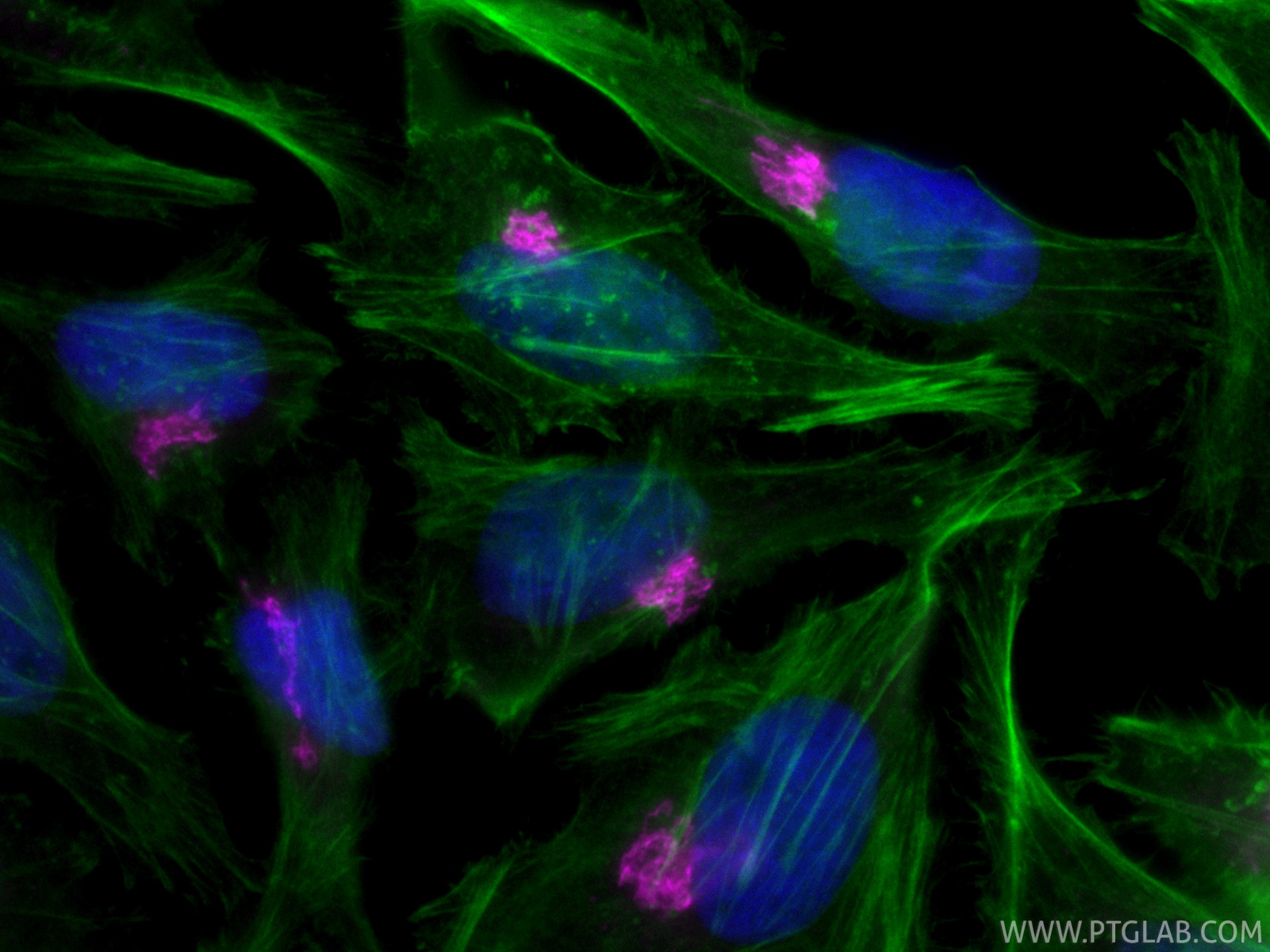 IF Staining of HeLa using CL647-11308