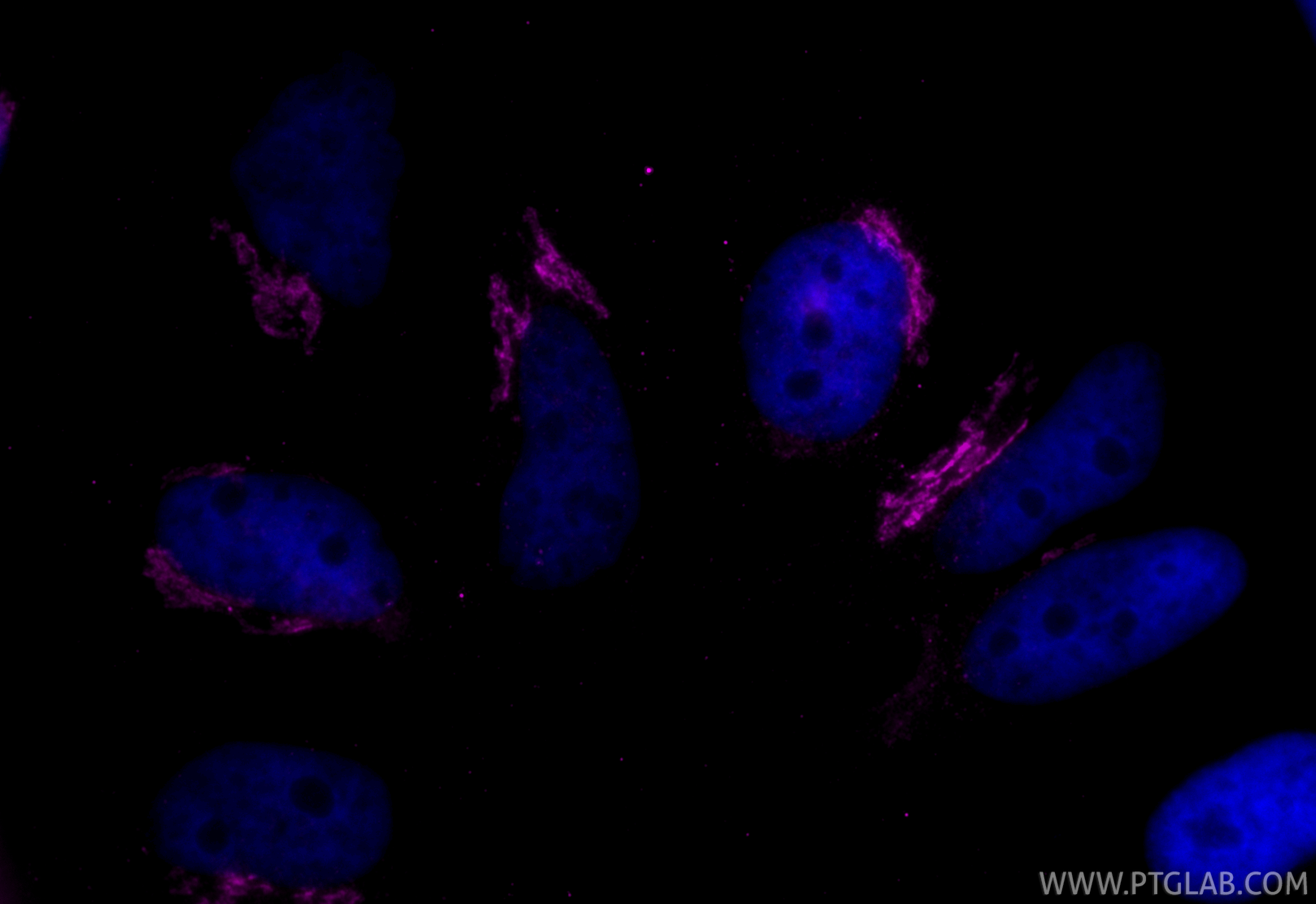 IF Staining of HeLa using CL647-66662 IF Staining of HeLa using CL647-66662