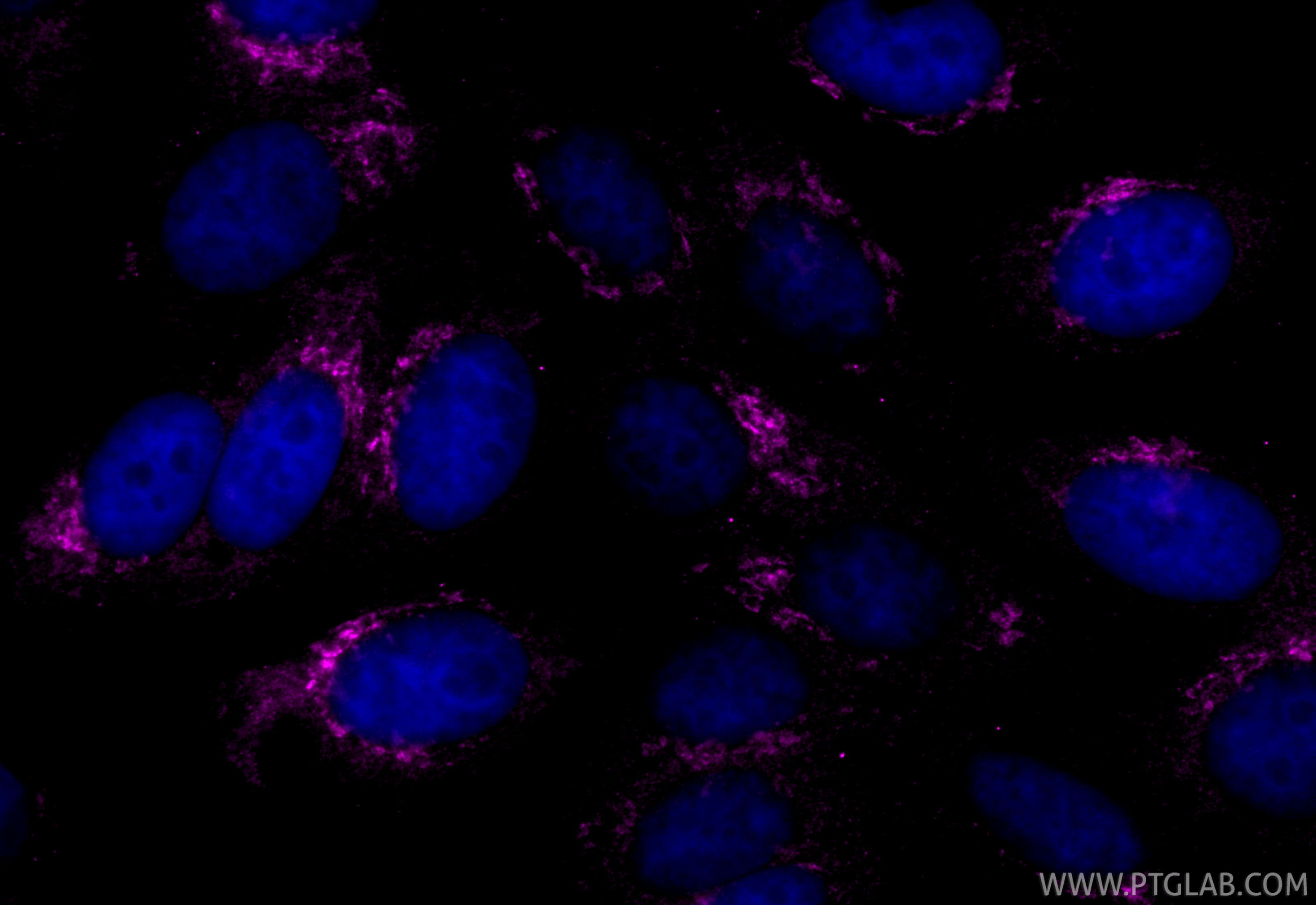 IF Staining of HepG2 using CL647-66662 IF Staining of HepG2 using CL647-66662