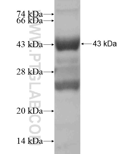 GOLGA2L1 fusion protein Ag19521 SDS-PAGE GOLGA2L1 fusion protein Ag19521 SDS-PAGE