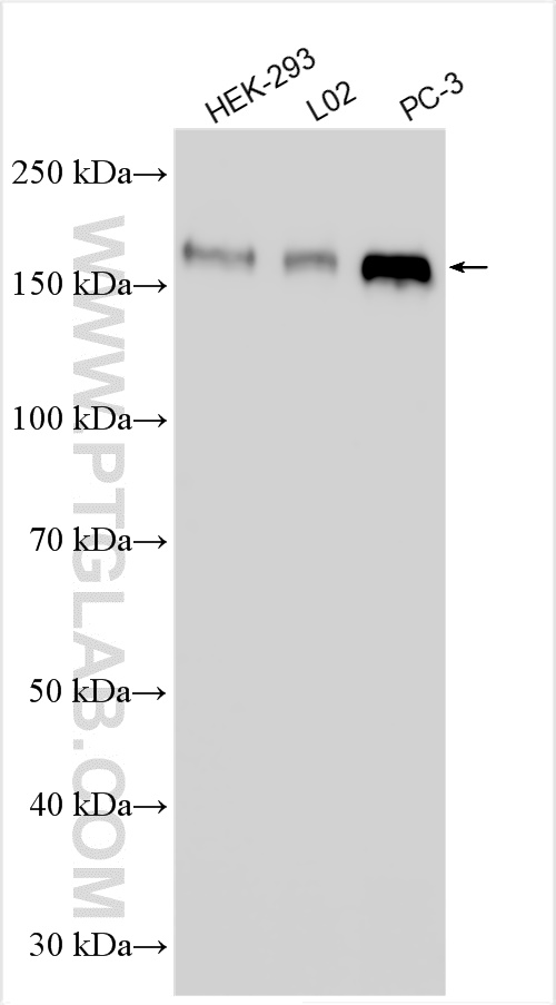 WB analysis using 21193-1-AP