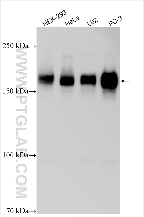 WB analysis using 21193-1-AP