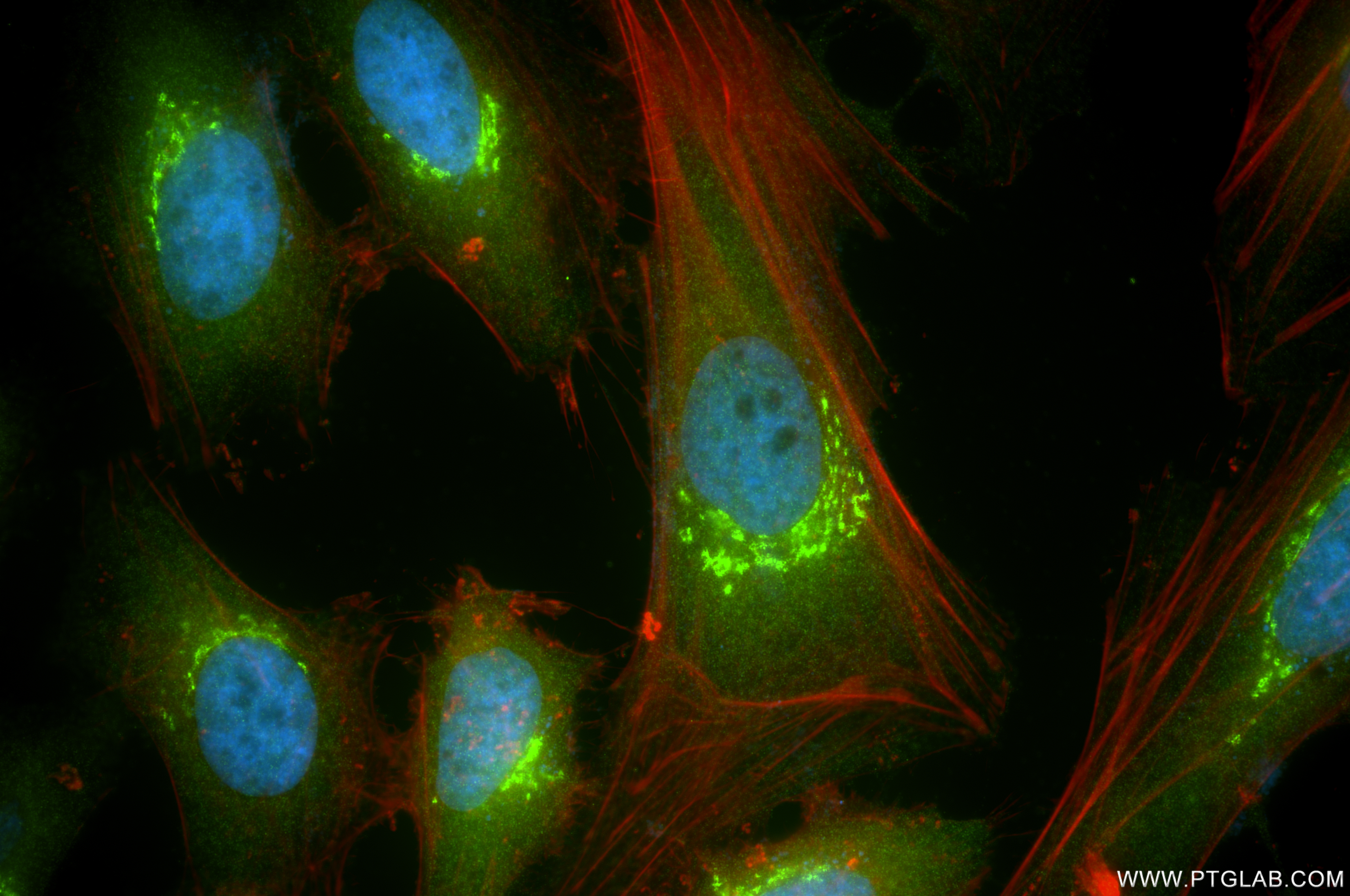 IF Staining of HeLa using 84955-4-RR