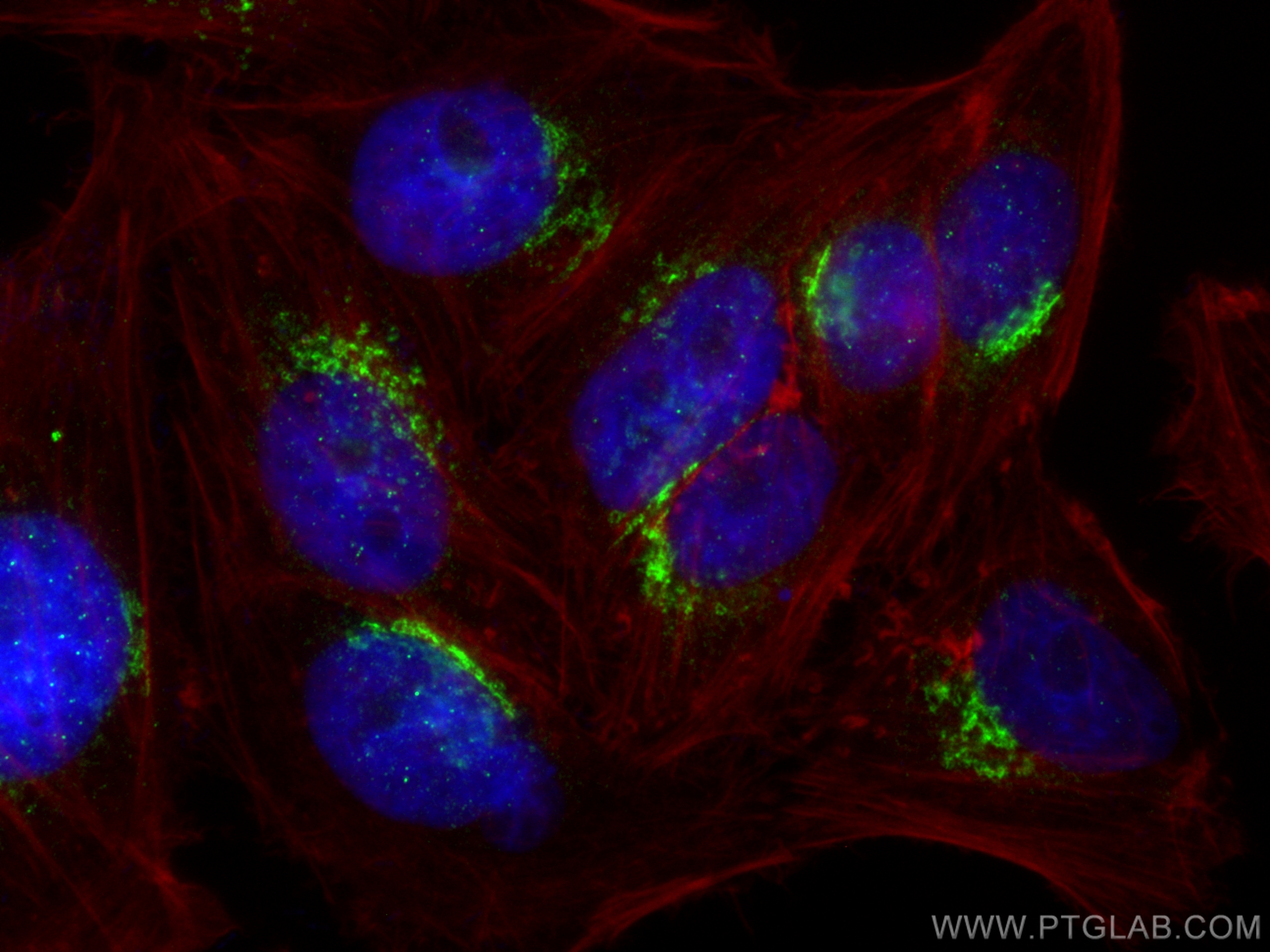IF Staining of HepG2 using 31164-1-AP