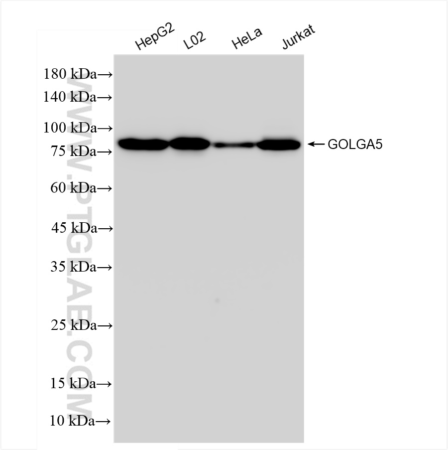 WB analysis using 83839-2-RR (same clone as 83839-2-PBS)