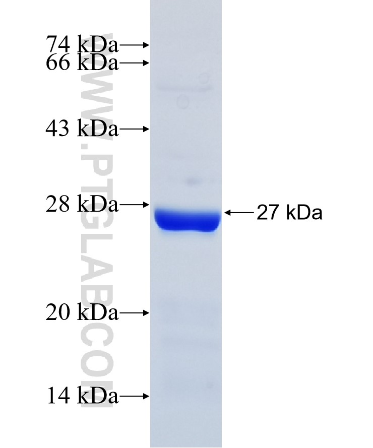 GOLGA5 fusion protein Ag36799 SDS-PAGE GOLGA5 fusion protein Ag36799 SDS-PAGE