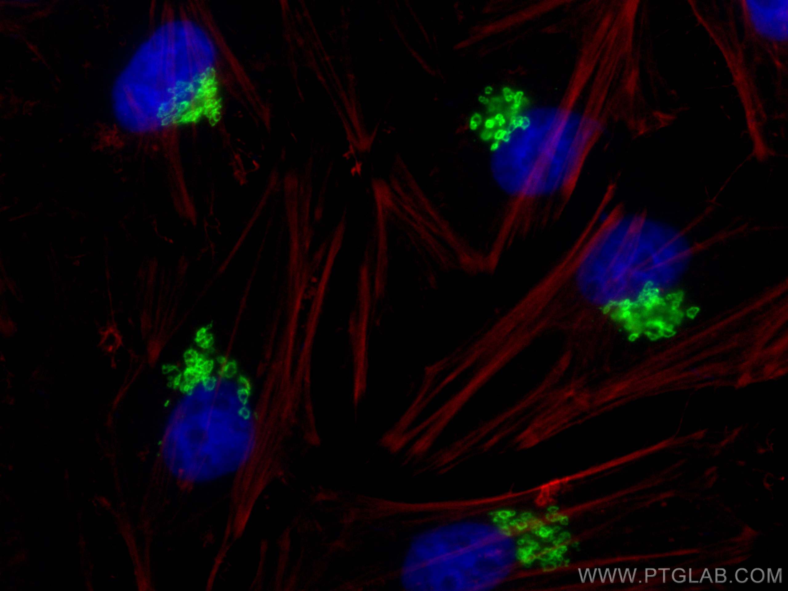 IF Staining of HeLa using 31083-1-AP