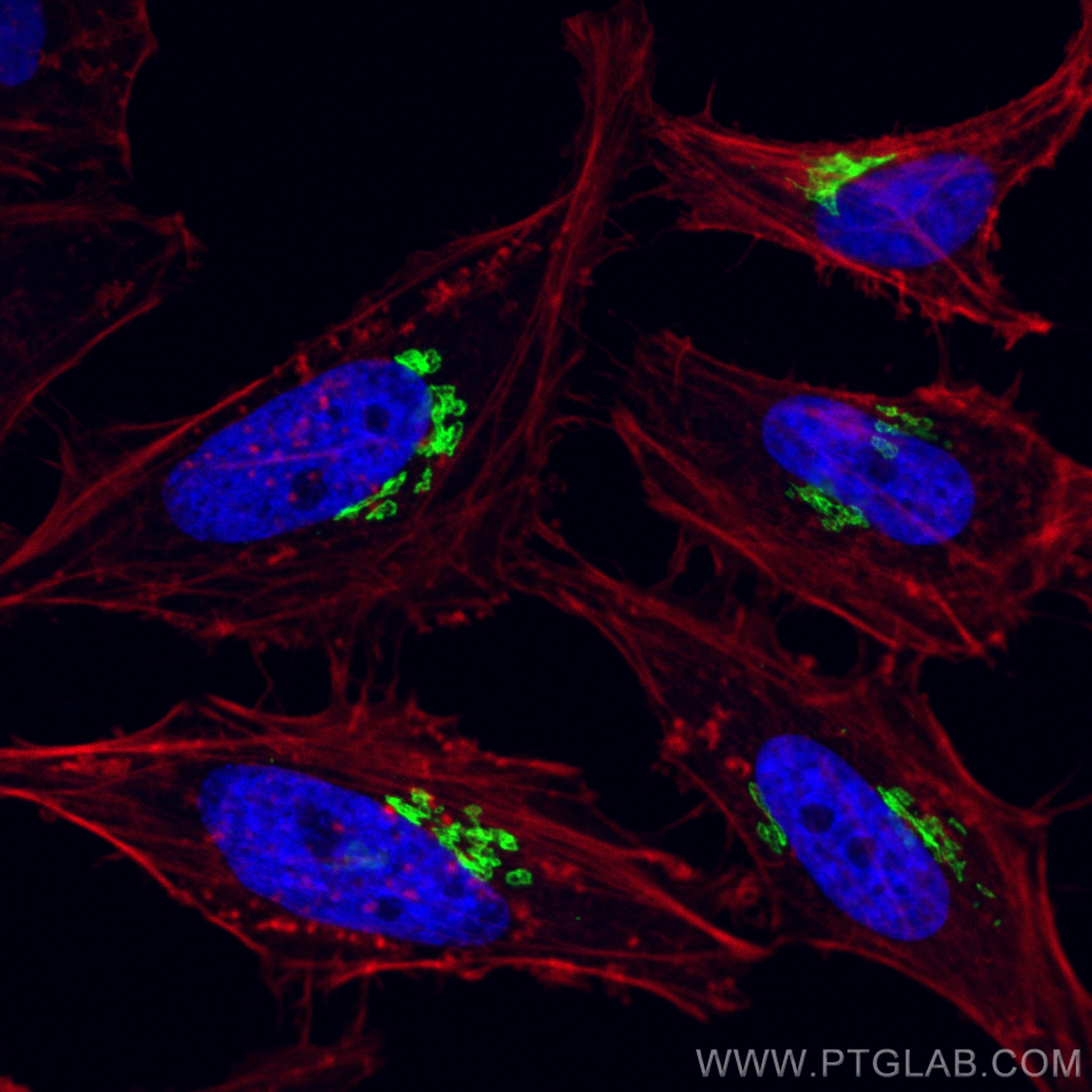 IF Staining of HeLa using 31083-1-AP