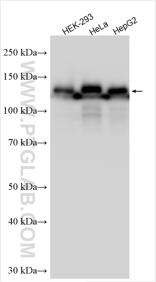 WB analysis using 31083-1-AP