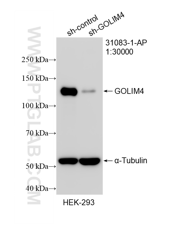 WB result of GOLIM4 antibody (31083-1-AP; 1:30000; incubated at room temperature for 1.5 hours) with sh-Control and sh-GOLIM4 transfected HEK-293 cells. WB analysis of HEK-293 using 31083-1-AP