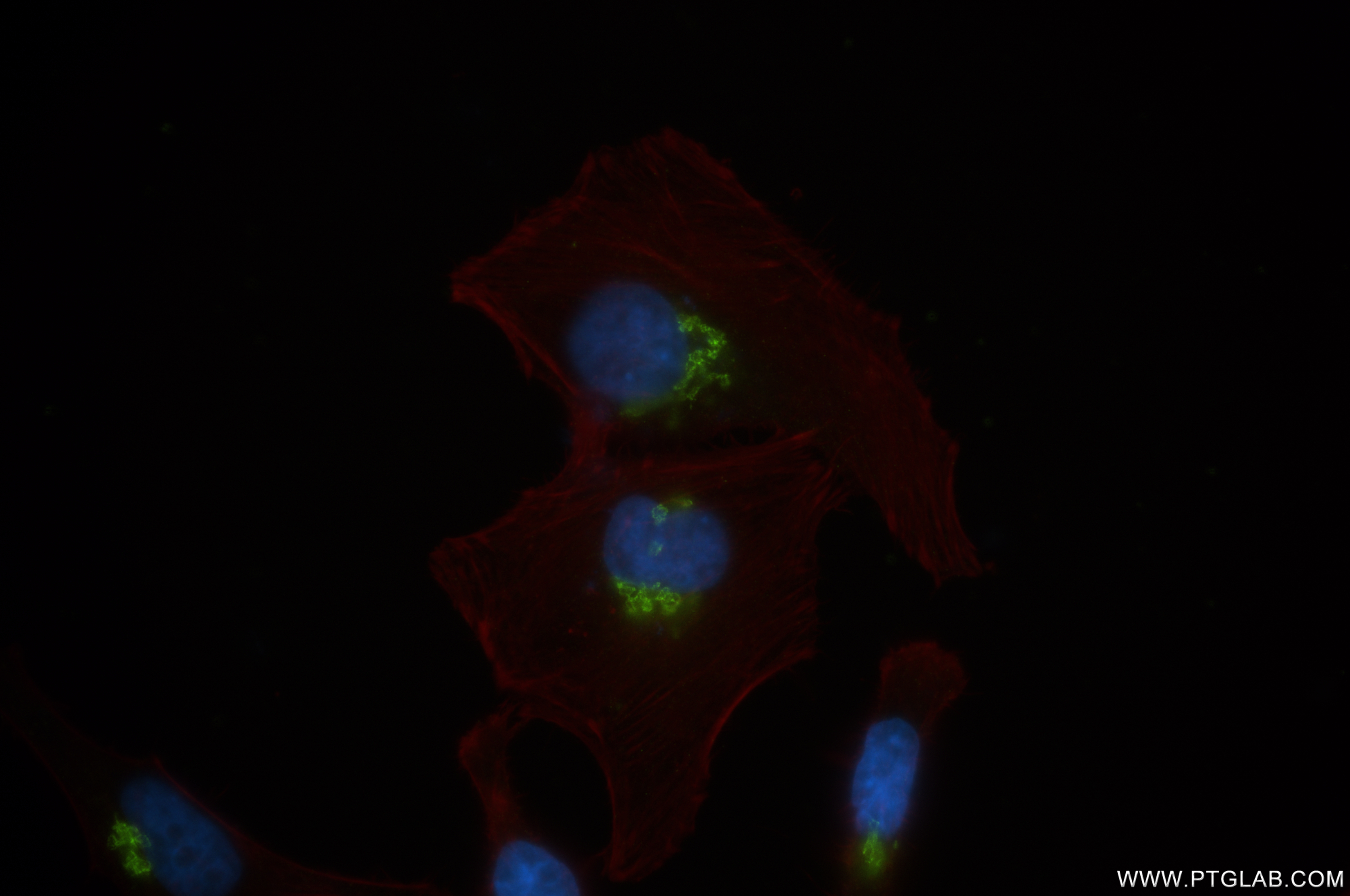 IF Staining of U2OS using 84818-5-RR
