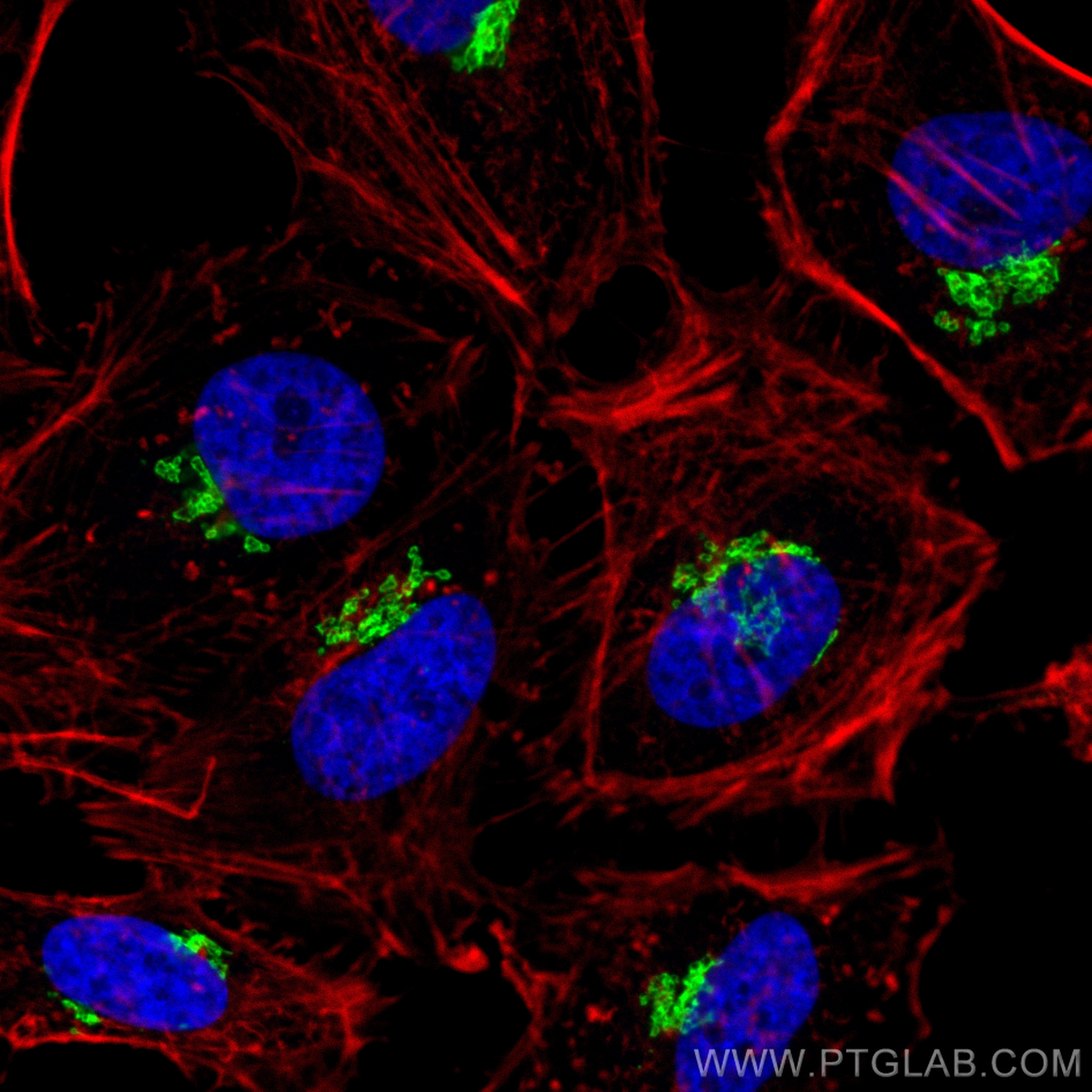 IF Staining of HeLa using 84818-5-RR (same clone as 84818-5-PBS)