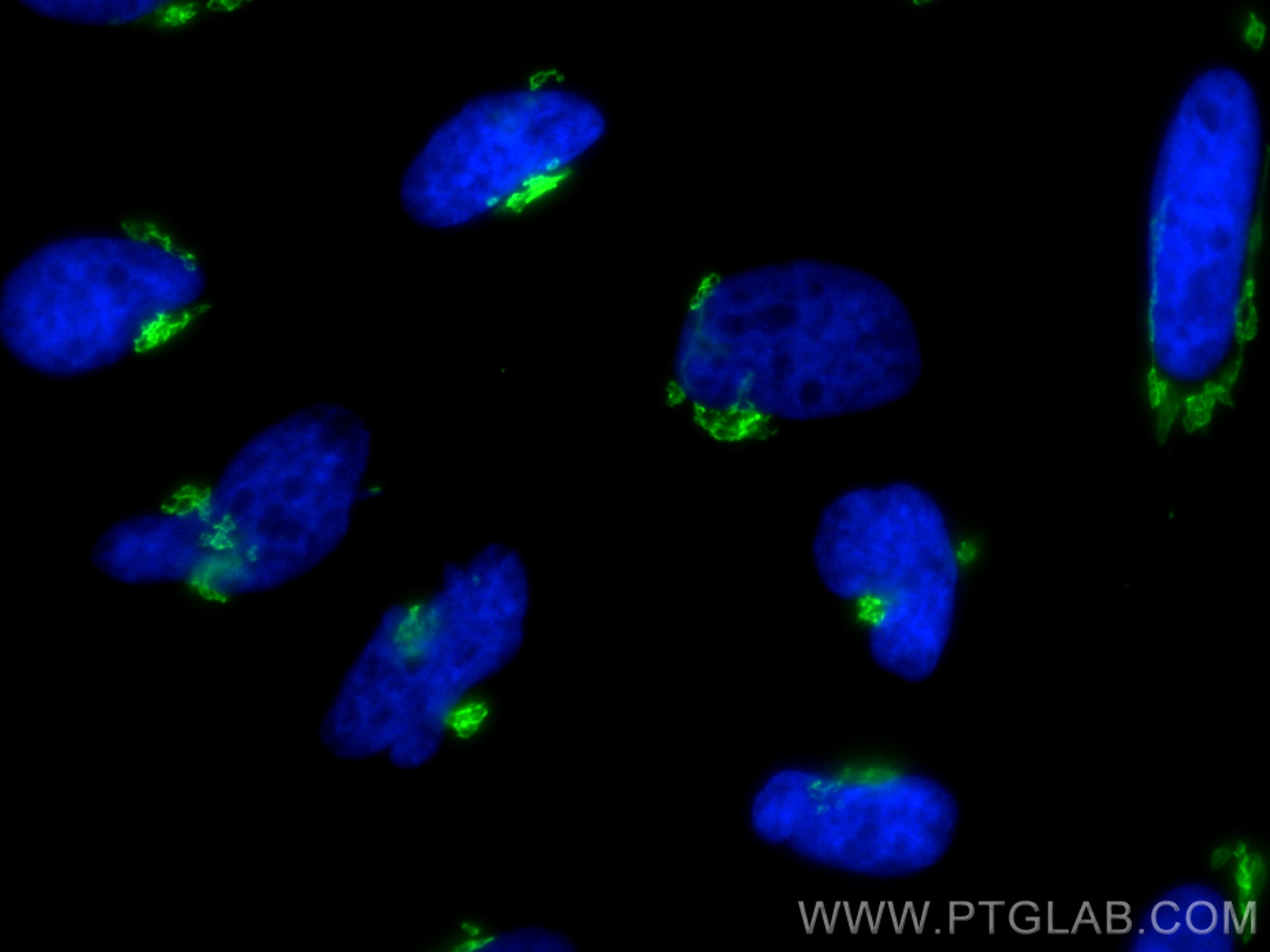 IF Staining of HeLa using CL488-84818-5