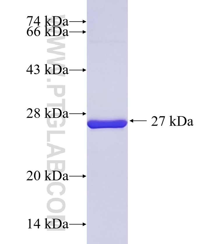 GOLIM4 fusion protein Ag34989 SDS-PAGE GOLIM4 fusion protein Ag34989 SDS-PAGE