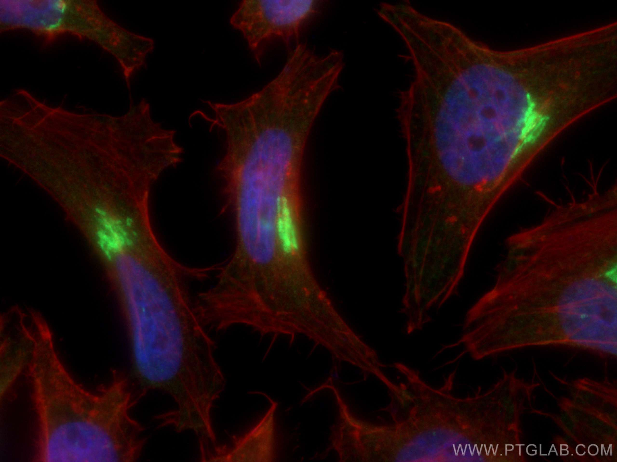 IF Staining of HeLa using 15126-1-AP