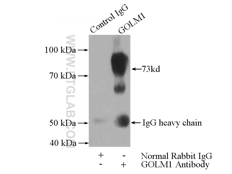 IP experiment of HeLa using 15126-1-AP