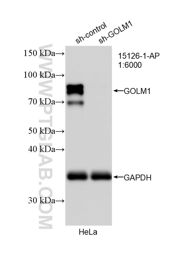 WB analysis of HeLa using 15126-1-AP WB analysis of HeLa using 15126-1-AP