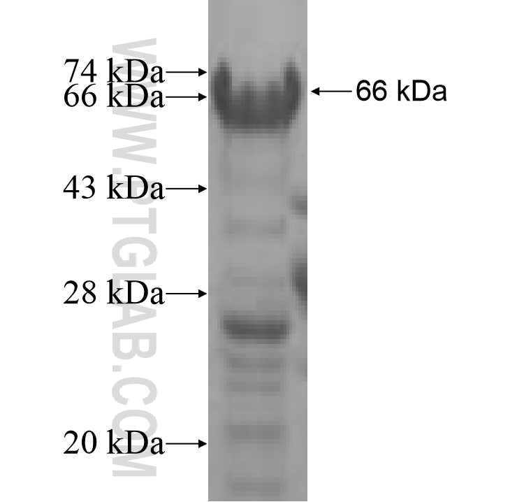 GOLM1 fusion protein Ag7474 SDS-PAGE GOLM1 fusion protein Ag7474 SDS-PAGE