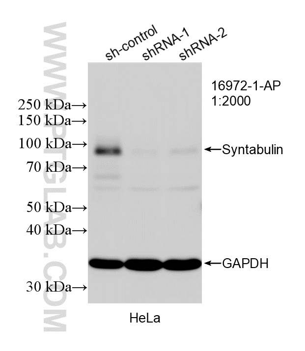 WB analysis of HeLa using 16972-1-AP